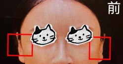 体验前-Yestar 嘉兴艺星医疗美容医院