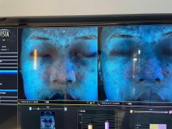 -苑苑vbeauty科技美容SPA