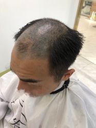 -发饰美男士增发补发假发定制店