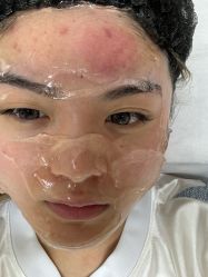 -Yestar宁波艺星整形医院