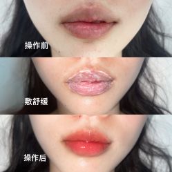 点击看大图 -OnFaer.纹眉半永久无创洗眉
