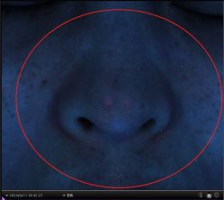 -韩国淼美颜皮肤管理官方直营店