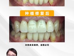 -惠安齿科(保利分院)