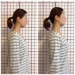 -FACE·日本小颜矫正美容整骨サロン