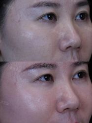 -Yestar重庆艺星医疗美容医院