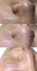 -MLP美丽派·问题肌疗愈中心