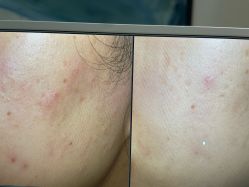 点击看大图 -苑苑vbeauty科技美容SPA