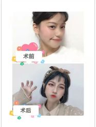 -广东韩妃整形外科医院