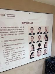 点击看大图 -熙朵美学植发连锁