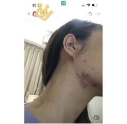-美瑞莎创美医疗美容