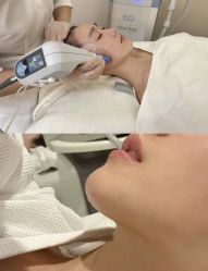 -LUNA皮相美·骨相美高级美感