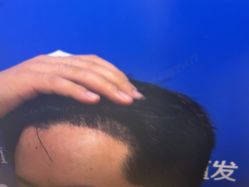 -雍禾植发全国连锁