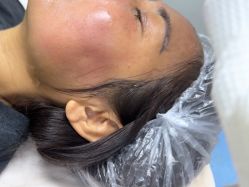 -长沙雅美医疗美容医院