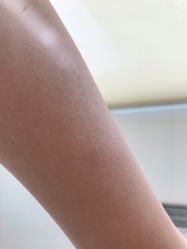 -上海玫瑰医疗美容医院