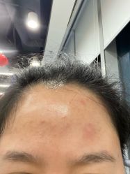 -Yestar重庆艺星医疗美容医院