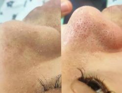 点击看大图 -SKIN79皮肤管理中心