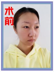 -苏州奥拉克美容医院