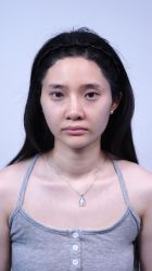 -佛山曙光金子医学美容医院