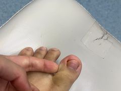 -新甲连锁灰指甲·甲沟炎·鸡眼(黑龙江路店)