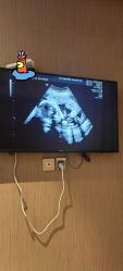 点击看大图 -重庆安琪儿妇产医院-妇幼保健联盟医院
