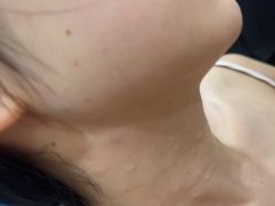 点击看大图 -重庆军科整形美容医院