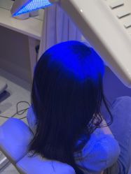 -碧莲盛·脱发养发中心