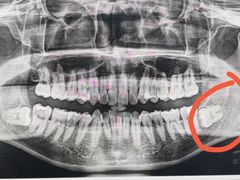 -华西牙科·四川口腔医院