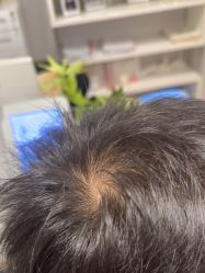 -熙朵美学植发·连锁品牌