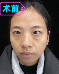 -素美医疗美容·西南眼鼻整形·修复基地