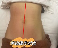 点击看大图 -Lily纤美·科技减脂中心