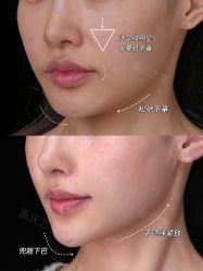 -Yestar重庆艺星医疗美容医院