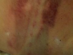 -莱蔻·圣灸堂·推拿艾灸(天山店)