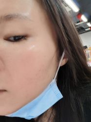 -小忠丽格医美