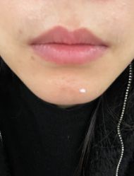 -南京美莱医疗美容·旗舰店