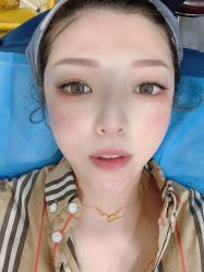 体验后-北京炫美医疗美容