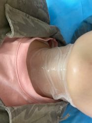 体验后-南京康美美容医院·旗舰店