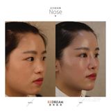 玻尿酸的功效真是太强大了！！