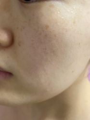 体验前-圣嘉新医疗美容医院