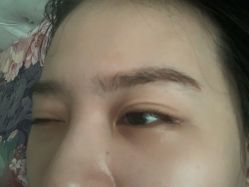 -悟空祛痘·诺奖技术专业店