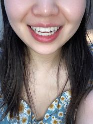 体验后-安徽合肥韩美整形外科医院