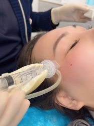 -More摩尔医美の注射线雕光电中心