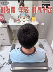 -唐风采假发补发定制