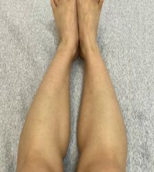 体验后-杭州医巢医疗美容