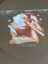 -郑州万安妇产医院