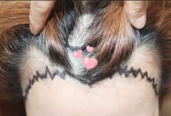 -大麦微针植发全国连锁