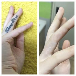 -净肤洗纹身
