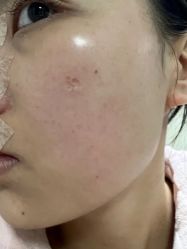 -杭州美莱医疗美容医院