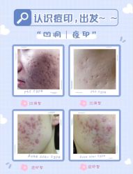 -苗方清颜痘肌研究所