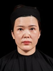 体验前-南宁华美医疗美容医院