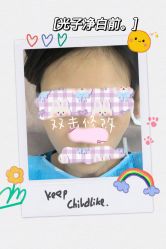 -KS科逆美肤祛痘